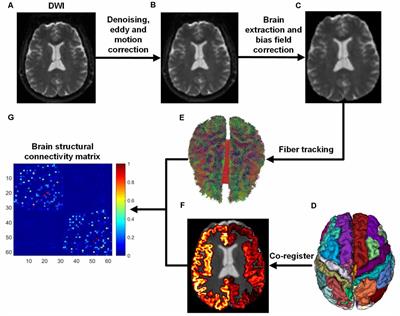 Interactions Between Aging and Alzheimer’s Disease on Structural Brain Networks